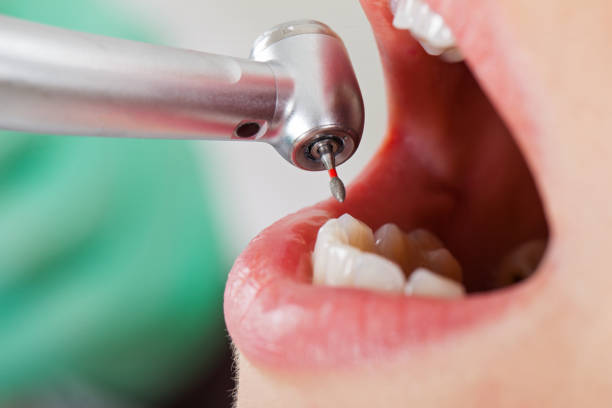 Best Walk-In Emergency Dentist in Pella, IA